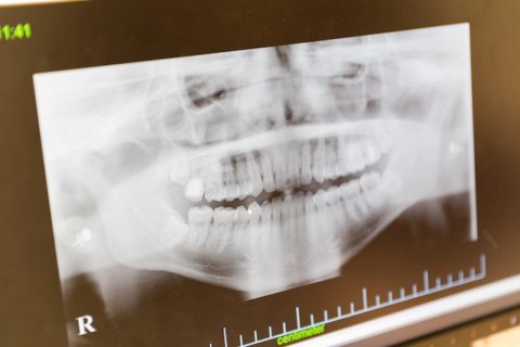 タチバナ歯科医院画像診断